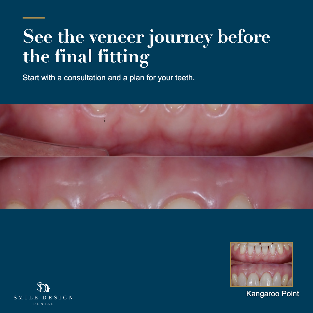 First finished Smile Design Dental image ad