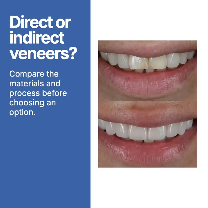 Second finished Smile Design Dental image ad
